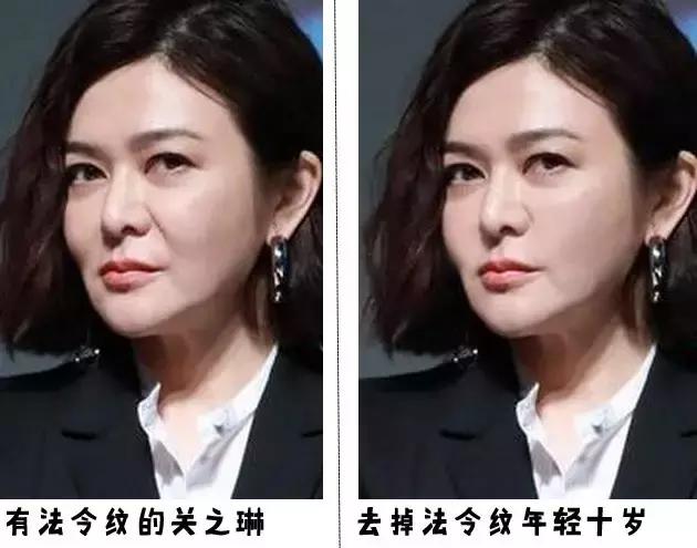 听说爱笑的女孩子法令纹都很深,爱笑的女孩真的容易得法令纹吗