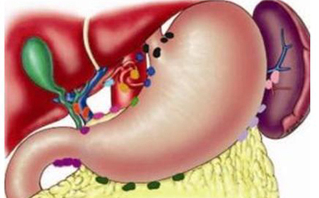 口干口苦口臭尿多是什么病,口苦口臭口干教你一招百试百灵
