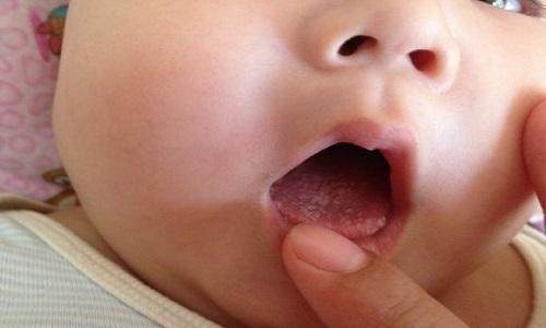 母乳宝宝体检不合格,母乳喂养的孩子健康吗