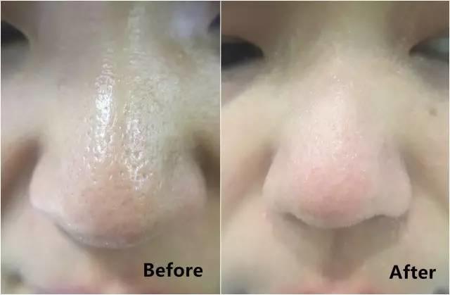 rydeen白泥清洁泥膜效果怎么样,平价好用的清洁泥膜测评