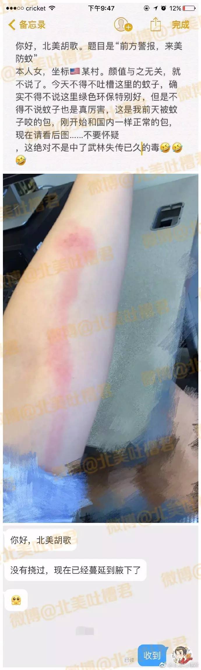 外国人被蚊子咬了后背长了个大包,被蚊子咬后留下硬疙瘩图片