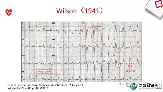 「心声」从机制到临床，一起认识左束支阻滞！