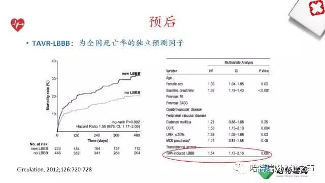 「心声」从机制到临床，一起认识左束支阻滞！
