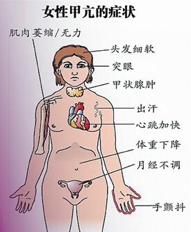 多碘甲亢和缺碘甲亢哪种好治疗,甲亢治疗后转为亚临床甲亢怎么办