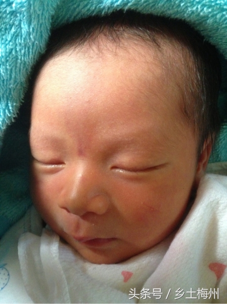 小孩身上长痱子一洗澡都红了,孩子长痱子可以用冷水洗吗