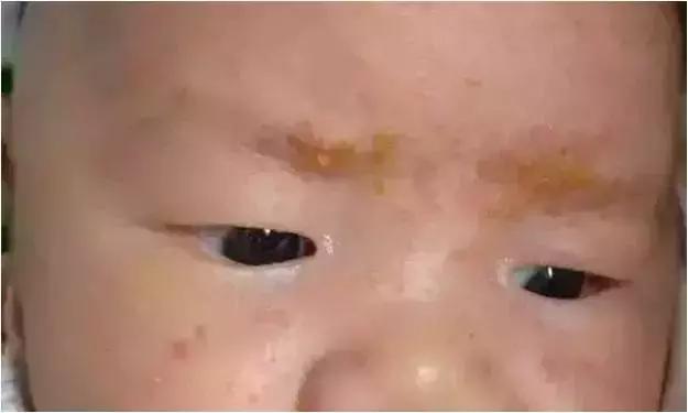 儿保体检有多坑,儿保体检准确么