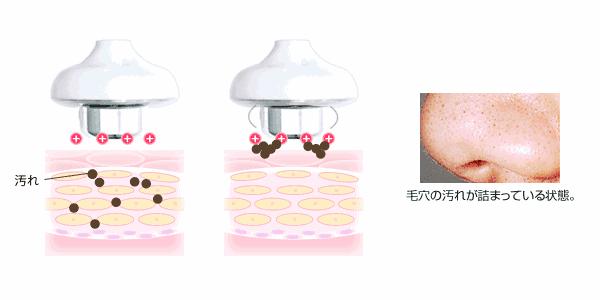 美容仪日立50000和59000区别,美容仪日立n4000