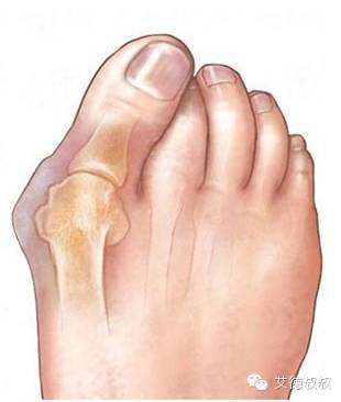 怎么有效教孩子区分左右鞋,对于穿错鞋子的孩子教育措施