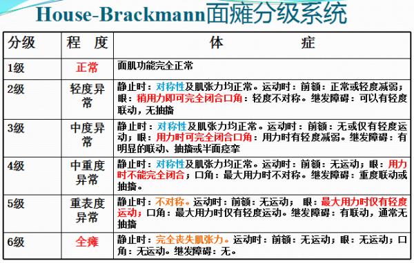 关于面瘫有哪些治疗方法,面瘫病因研究