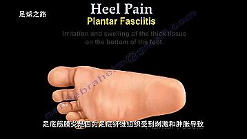 足跟痛的症状及表现,足跟痛最常见病因