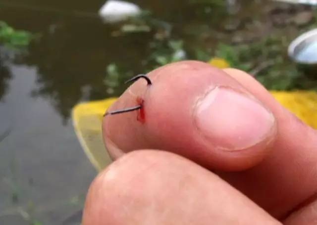 鱼钩倒刺刺进肉里怎么弄出来,有倒刺的鱼钩扎到肉如何取