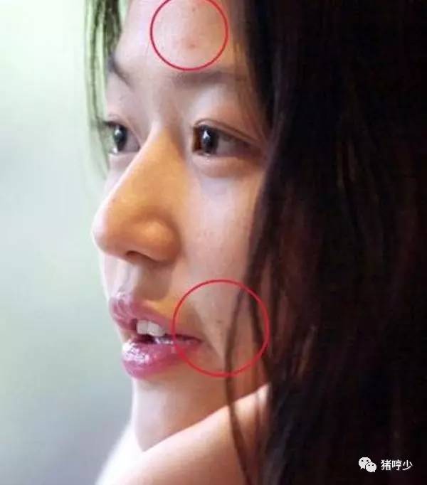明星皮肤真的不长痘吗,脸上不长痘
