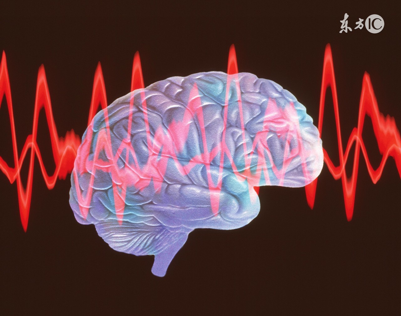 儿童癫痫查不出脑电图异常,脑电图说癫痫磁共振没查出病因