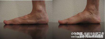 怎么站立可以改善足弓塌陷,如何站立练背