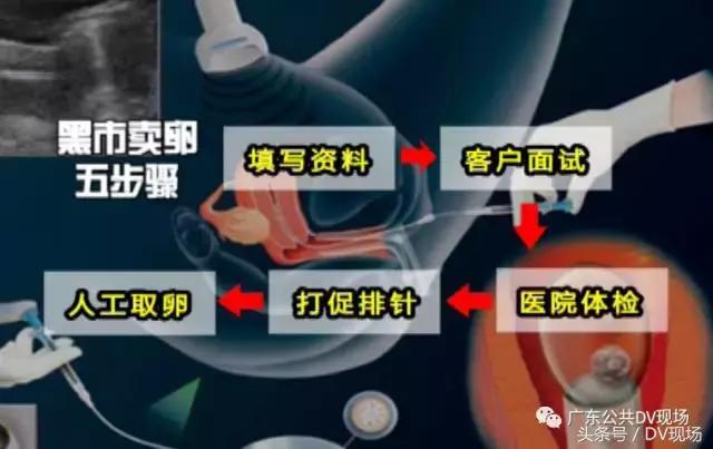 悲剧!广州妙龄女子为赚1.5万卖卵,不幸肚子变大