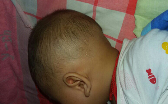 醒来后出一身汗用哪个穴位调理,没怎么动就大汗淋漓