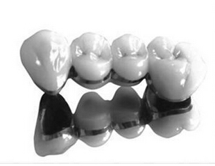 义齿知识普及,劣质义齿对身体有哪些害处