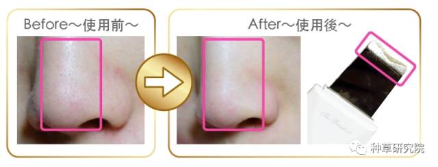 怎么让皮肤光滑如蛋清,怎样能让皮肤变得和鸡蛋一样光滑