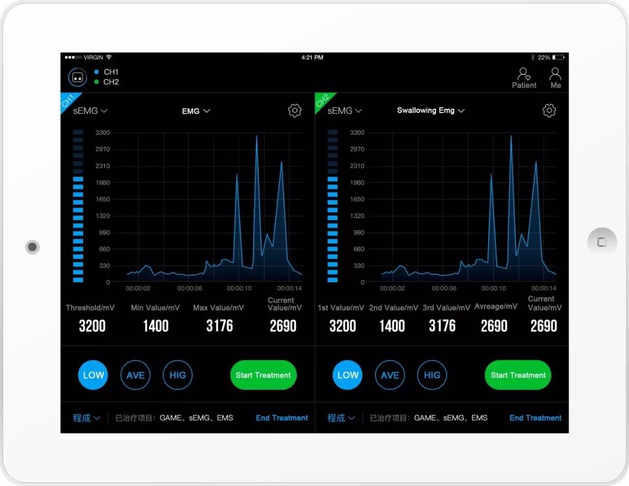 讯丰通xft肌电生物反馈仪,讯丰通第四代电刺激仪