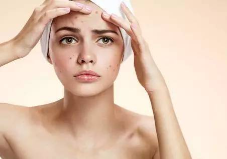 战痘合集完整版,战痘大结局完整版