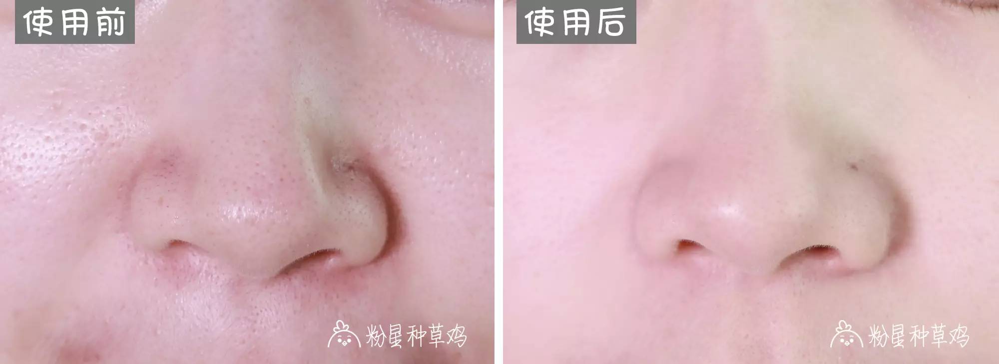 平价清洁面膜泥哪个牌子好,清洁面膜真实评测推荐