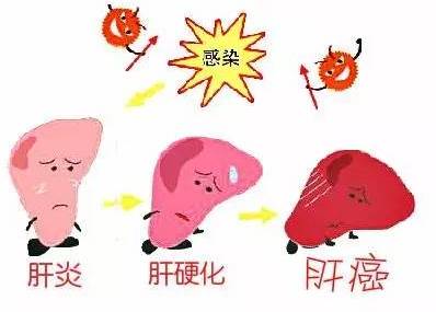 妙手仁心治疗,医者仁心重症肝炎