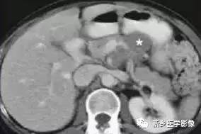 18种疾病包括哪些,18种肿瘤有哪些