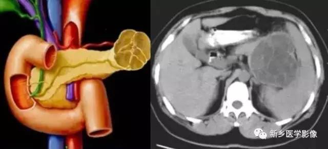 18种疾病包括哪些,18种肿瘤有哪些