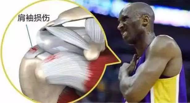 肩袖损伤手术后康复期咔咔响,老年人肩袖损伤康复训练视频