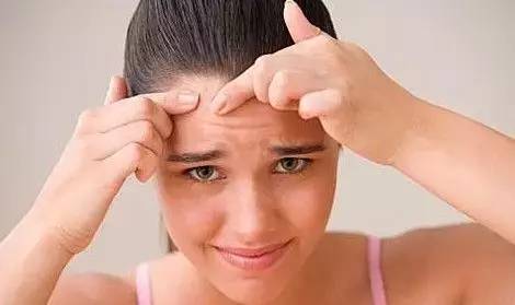 再也不担心脸上长痘痘,再也不用因为痘痘而烦恼