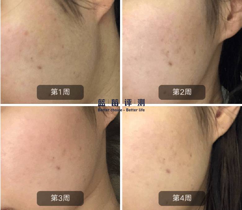 有哪些比较好用的美容仪可以推荐,最好用的有效的美容仪