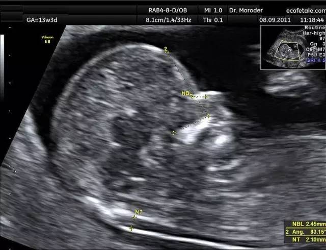 b超发现某些问题一定要处理么,b超发现问题需要处理吗