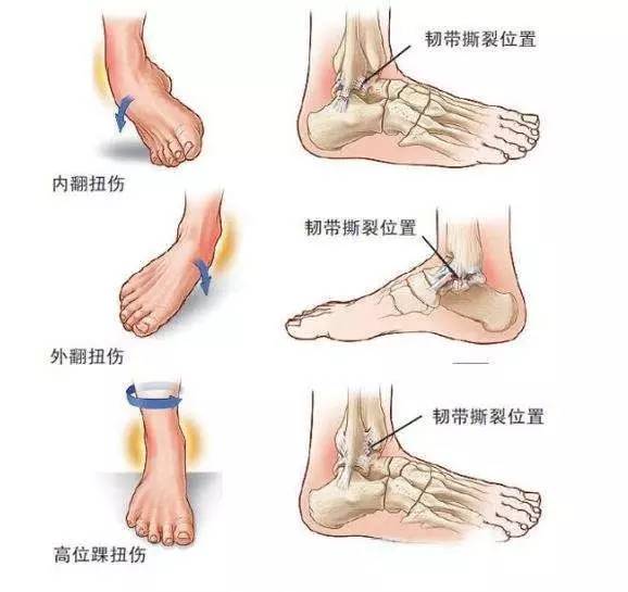 夏天如何保护脚踝不受凉,天气冷脚踝怎么保护