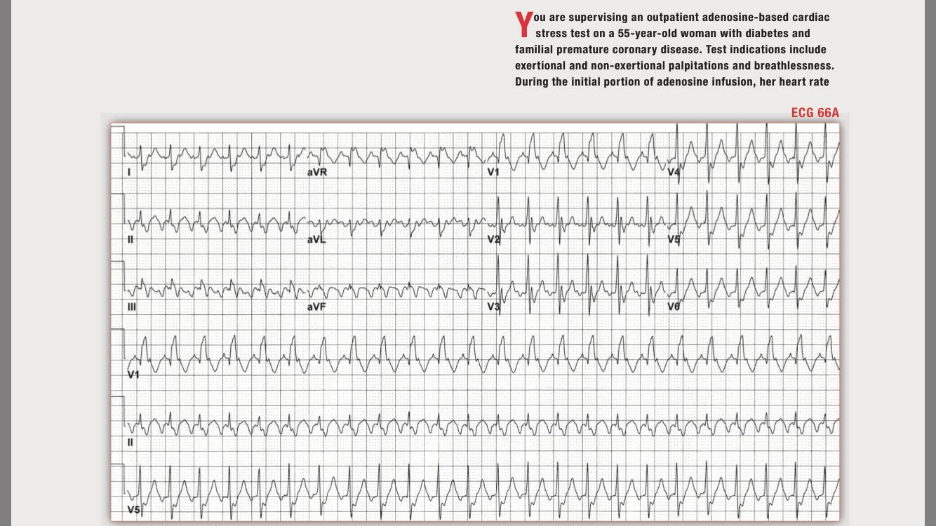 读心有术216,读心有术236期