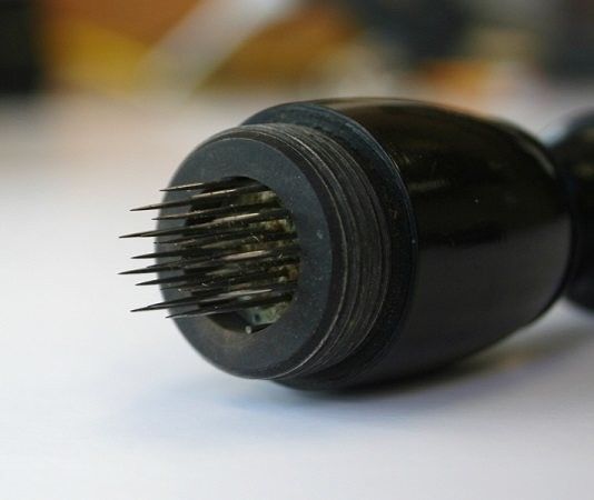 19世纪的针刺万能疗法是这样的