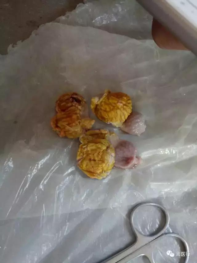 腺肌胃炎，我想买个冒火的加特林哒哒死你