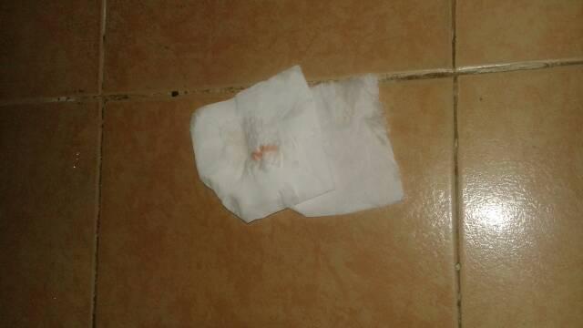 怀孕初期遇到出血的情况怎么办?