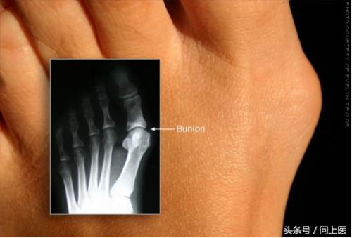 脚的10大症状图片,脚最容易得这8种病