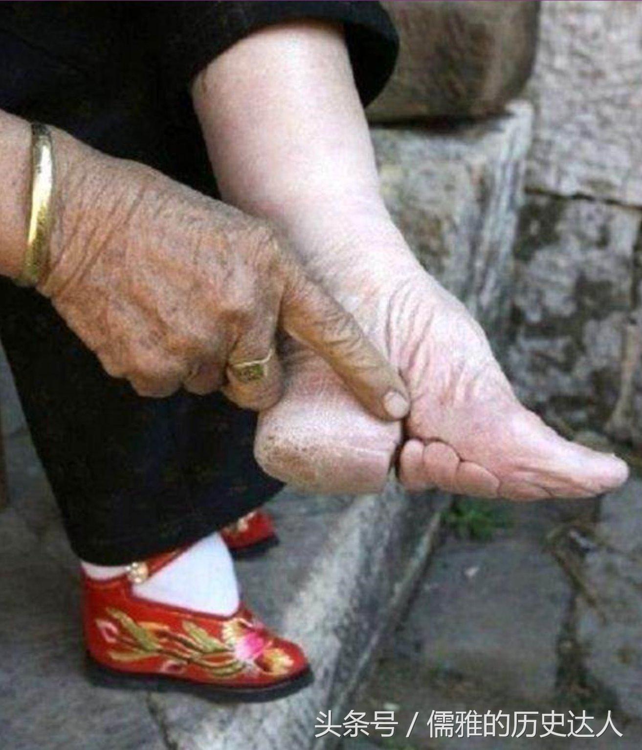 古代的缠足对女性的摧残有多大?为何古代男人们喜欢‘三寸金莲’