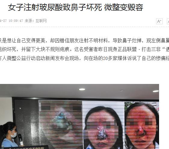 娱乐圈不老男神的秘诀,明星们的冻龄秘诀玻尿酸