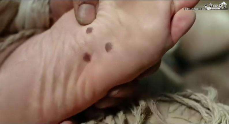 看看你脸上的痣有什么特殊含义,有些人的身上有痣代表着什么