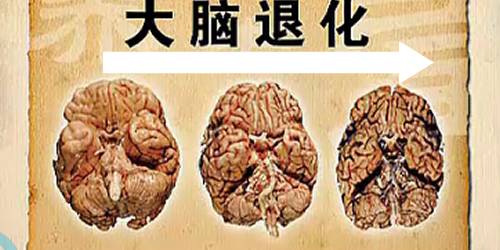 大脑为什么20岁就开始衰老,22岁记忆力下降得很厉害