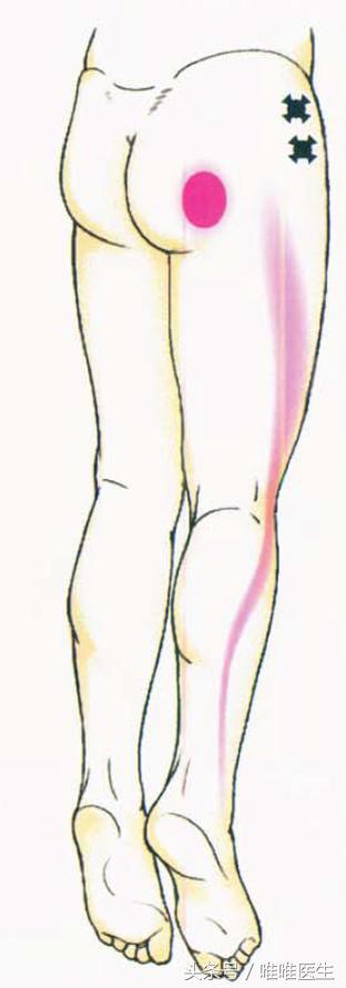 膝关节科普文章,膝关节疼痛最全解析