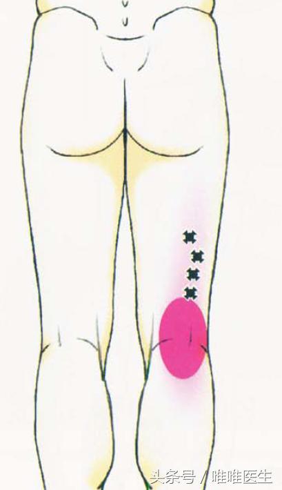 膝盖疼痛治疗经验分享,膝关节总结