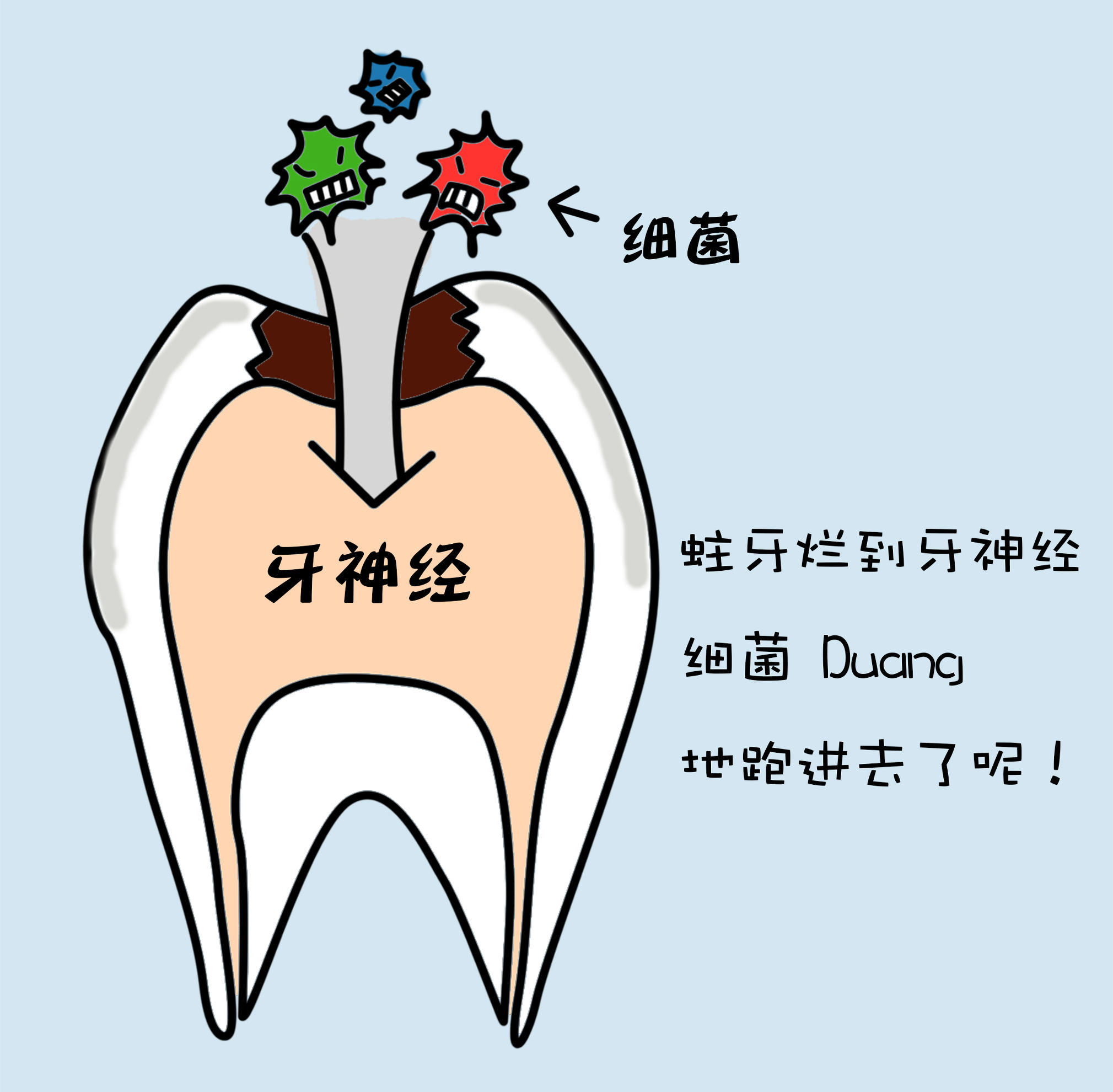 根管治疗是什么作用,根管治疗是什么情况下要做