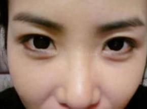 宝宝的眉需要剃吗,新生儿有必要剃眉毛么