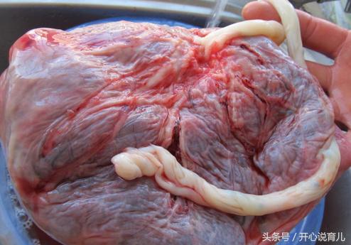 胎盘能吃吗有什么作用和坏处,胎盘你们是怎么处置的