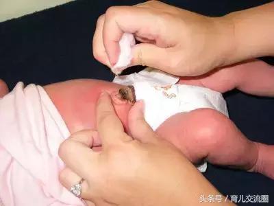 新生儿肚脐脱落前消毒视频,肚脐脱落后还要消毒多久