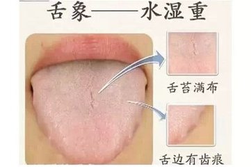 老中医看一眼就知道男子有病,老中医是如何看出某人有肛裂的