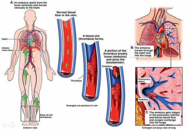 肺腺癌不能手术靶向治疗怎么样,肺腺癌转移到胸膜可以手术治疗吗